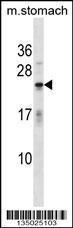 Anti-TNNI2 Rabbit Polyclonal Antibody