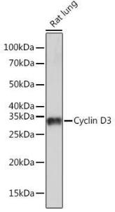 Anti-Cyclin D3 / CCND3 Rabbit Monoclonal Antibody [clone: ARC0325]