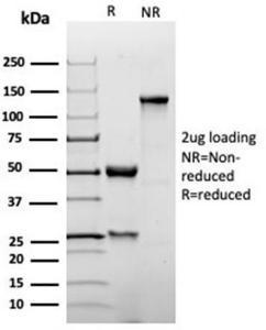 SDS-PAGE analysis of Anti-p27 Kip1 Antibody [KIP1/1355R] under non-reduced and reduced conditions; showing intact IgG and intact heavy and light chains, respectively. SDS-PAGE analysis confirms the integrity and purity of the antibody