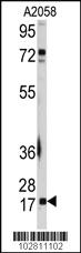 Anti-UBE2I Rabbit Polyclonal Antibody