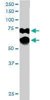 Anti-PPP2R5D Goat Polyclonal Antibody