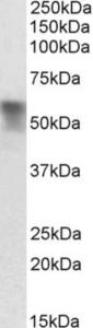 EB10756 (0.03 µg/ml) staining of Rat Liver lysate (35 µg protein in RIPA buffer). Primary incubation was 1 hour. Detected by chemiluminescence.