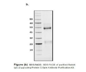 SDS-PAGE of Purified Rabbit IgG