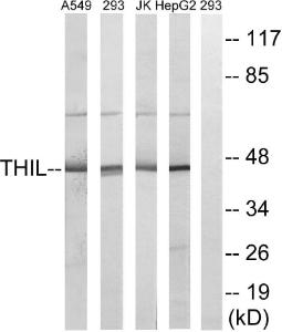 Western blot analysis of lysates from HepG Jurkat, 293, and A549 cells using Anti-ACAT1 Antibody. The right hand lane represents a negative control, where the Antibody is blocked by the immunising peptide