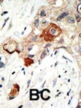 Anti-UBE2I Rabbit Polyclonal Antibody