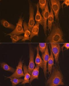 Immunofluorescence analysis of NIH-3T3 cells using Anti-RAP1GAP Antibody [ARC2058] (A307431) at a dilution of 1:100 (40X lens). DAPI was used to stain the cell nuclei (blue)