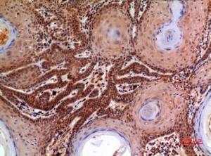 Immunohistochemical analysis of paraffin-embedded human skin using Anti-A2M Antibody