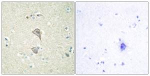 Immunohistochemical analysis of paraffin-embedded human brain tissue using Anti-NKTR Antibody. The right hand panel represents a negative control, where the antibody was pre-incubated with the immunising peptide