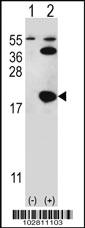 Anti-UBE2I Rabbit Polyclonal Antibody