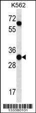 Anti-PI15 Rabbit Polyclonal Antibody