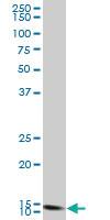 Anti-FIS1 Mouse Monoclonal Antibody [clone: 3G6]