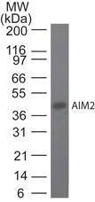 Anti-AIM2 Mouse Monoclonal Antibody [clone: 10M2B3]