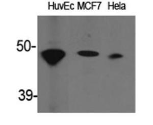 Western blot analysis of various cells using Anti-ACAT1 Antibody