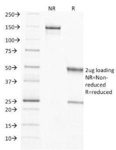 Anti-TIMP2 antibody