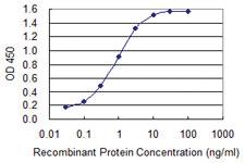 Anti-LETM1 Mouse Monoclonal Antibody [clone: 2C6]