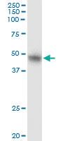 Anti-SMYD2 Polyclonal Antibody Pair