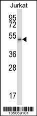 Anti-CDK15 Rabbit Polyclonal Antibody (FITC (Fluorescein Isothiocyanate))