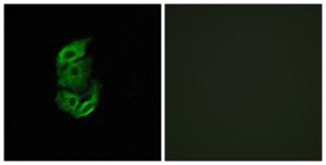 Immunofluorescence analysis of A549 cells using Anti-STA13 Antibody. The right hand panel represents a negative control, where the antibody was pre-incubated with the immunising peptide.