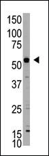 Anti-XIAP Rabbit Polyclonal Antibody