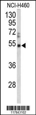 Anti-ADAMTS5 Rabbit Polyclonal Antibody