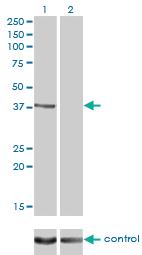 Anti-RAD51C Mouse Monoclonal Antibody [clone: 3F3-5C6]