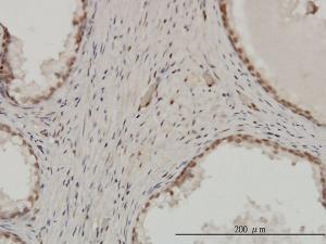 Anti-ZNF202 Mouse Monoclonal Antibody [clone: 1E9]