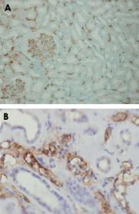 Anti-C4A Rabbit Monoclonal Antibody [clone: A24-T]