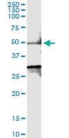 Anti-SMYD2 Polyclonal Antibody Pair