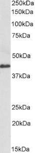 EB12513 (0.3 µg/ml) staining of Human Colorectal cancer lysate (35 µg protein in RIPA buffer). Primary incubation was 1 hour. Detected by chemiluminescence.