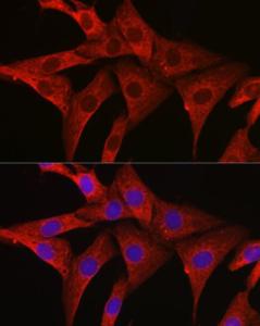 Immunofluorescence analysis of NIH/3T3 cells using Anti-SIRT3 Antibody (A308371) at a dilution of 1:100 (40X lens). DAPI was used to stain the cell nuclei (blue)