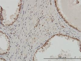 Anti-ZNF202 Mouse Monoclonal Antibody [clone: 1E9]