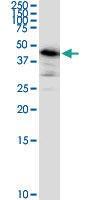 Anti-ARMC6 Mouse Monoclonal Antibody [clone: 2H8]