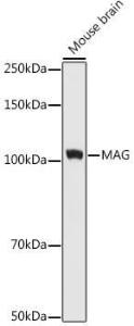 Western blot analysis of extracts of Mouse brain cells, using Anti-MAG/GMA Antibody [ARC1691] (A307434) at 1:1000 dilution. The secondary Antibody was Goat Anti-Rabbit IgG H&L Antibody (HRP) at 1:10000 dilution. Lysates/proteins were present at 25 µg per lane