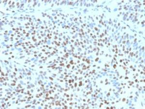 Immunohistochemical analysis of formalin-fixed, paraffin-embedded human bladder using Anti-p27 Kip1 Antibody [KIP1/1355R] at 2 µg/ml in PBS for 30 minutes at room temperature