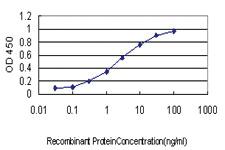 Anti-RAD51C Mouse Monoclonal Antibody [clone: 3F3-5C6]