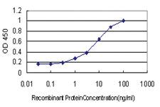 Anti-ZNF202 Mouse Monoclonal Antibody [clone: 1E9]