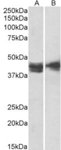 EB12522 (2 µg/ml) staining of Jurkat (A) and Molt4 (B) lysates (35 µg protein in RIPA buffer). Primary incubation was 1 hour. Detected by chemiluminescence.