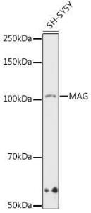 Western blot analysis of extracts of SH-SY5Y cells, using Anti-MAG/GMA Antibody [ARC1691] (A307434) at 1:1000 dilution. The secondary Antibody was Goat Anti-Rabbit IgG H&L Antibody (HRP) at 1:10000 dilution. Lysates/proteins were present at 25 µg per lane