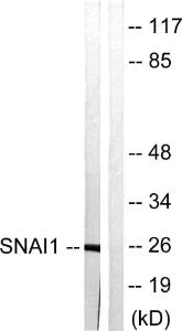 Western blot analysis of lysates from HT29 cells using Anti-SNAI1 Antibody The right hand lane represents a negative control, where the antibody is blocked by the immunising peptide