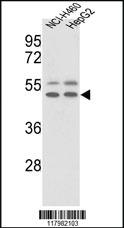 Anti-VTN Rabbit Polyclonal Antibody