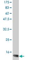 Anti-CSF2 Mouse Monoclonal Antibody [clone: 2A8]