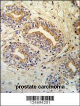 Anti-CWC15 Rabbit Polyclonal Antibody (Biotin)