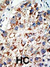 Anti-UBA2 Rabbit Polyclonal Antibody