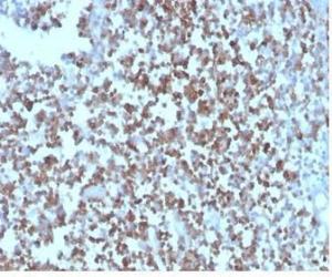 Immunohistochemical analysis of formalin-fixed, paraffin-embedded human tonsil tissue using Anti-CD27 Antibody [LPFS2/4178]