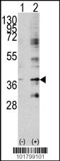 Anti-BIRC7 Rabbit Polyclonal Antibody