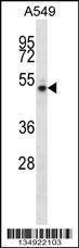 Anti-NUDCD1 Rabbit Polyclonal Antibody (Biotin)