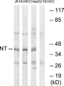 Western blot analysis of lysates from HUVEC, HepG and Jurkat cells using Anti-NT Antibody. The right hand lane represents a negative control, where the antibody is blocked by the immunising peptide.