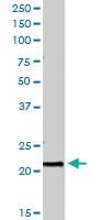 Anti-PTP4A1 Goat Polyclonal Antibody