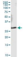 Anti-VAPA Polyclonal Antibody Pair