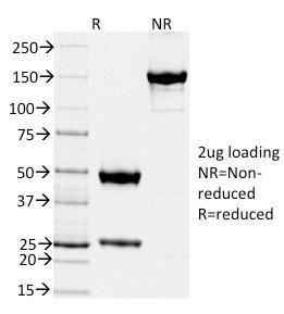 SDS-PAGE analysis of Anti-TIMP2 Antibody [TIMP2/2044] under non-reduced and reduced conditions; showing intact IgG and intact heavy and light chains, respectively SDS-PAGE analysis confirms the integrity and purity of the antibody